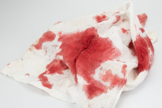 ako-odstranit-krv-z-oblecenia-1580718675